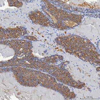 ACAD9 Rabbit Polyclonal Antibody
