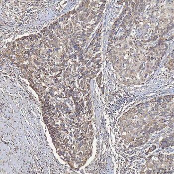ACAD9 Rabbit Polyclonal Antibody
