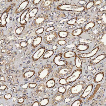 ACAD9 Rabbit Polyclonal Antibody