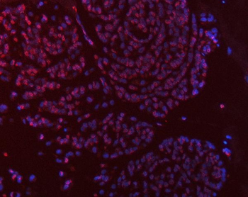 Thymidylate Synthase/TYMS Rabbit Polyclonal Antibody
