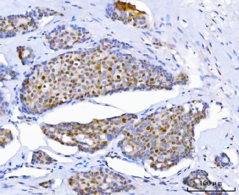 Thymidylate Synthase/TYMS Rabbit Polyclonal Antibody