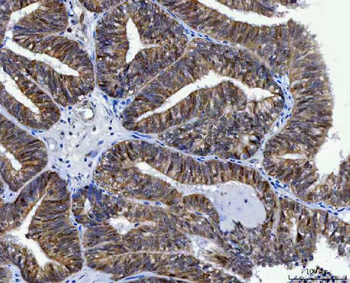 Thymidylate Synthase/TYMS Rabbit Polyclonal Antibody