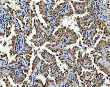 Thymidylate Synthase/TYMS Rabbit Polyclonal Antibody