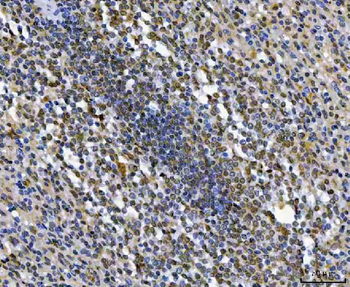 Thymidylate Synthase/TYMS Rabbit Polyclonal Antibody