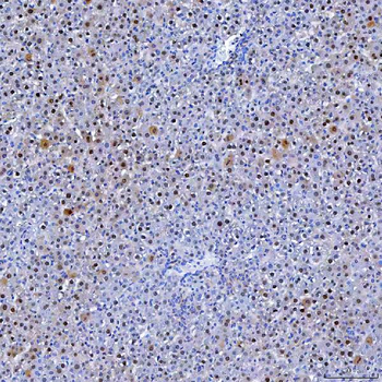 Thymidylate Synthase/TYMS Rabbit Polyclonal Antibody