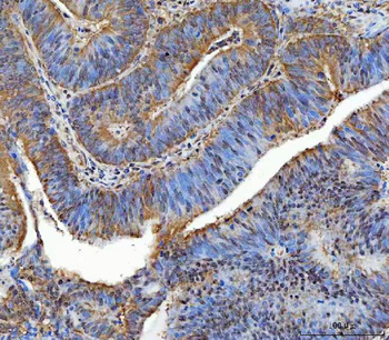 TTLL12 Rabbit Polyclonal Antibody