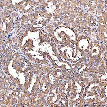TTLL2 Antibody