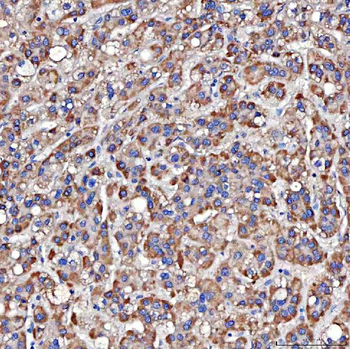 TTLL2 Antibody