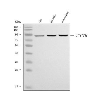 TTC7B Rabbit Polyclonal Antibody