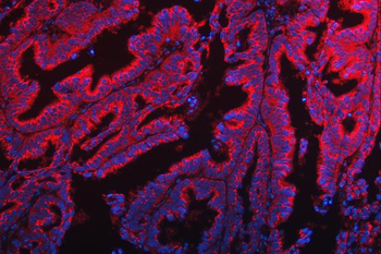 TTC7B Rabbit Polyclonal Antibody