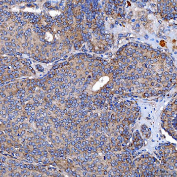 TTC7B Rabbit Polyclonal Antibody