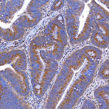 TTC7B Rabbit Polyclonal Antibody