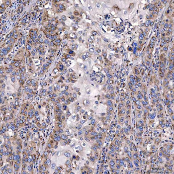 TTC7B Rabbit Polyclonal Antibody