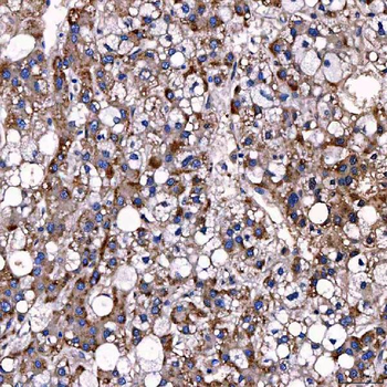 TTC7B Rabbit Polyclonal Antibody