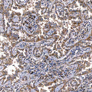 TTC7B Rabbit Polyclonal Antibody
