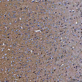 TTC7B Rabbit Polyclonal Antibody