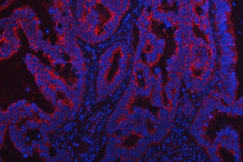 TRMT2B Rabbit Polyclonal Antibody