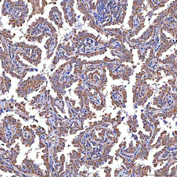 TRMT2B Rabbit Polyclonal Antibody