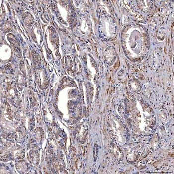 TRMT2B Rabbit Polyclonal Antibody