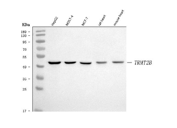 TRMT2B Rabbit Polyclonal Antibody