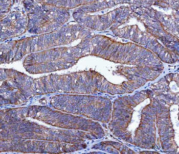LIN41/TRIM71 Antibody