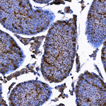 LIN41/TRIM71 Antibody