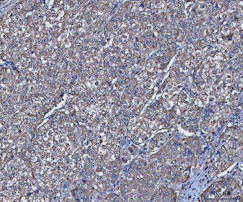 TRIM16 Rabbit Polyclonal Antibody