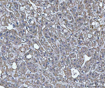 TRIM16 Rabbit Polyclonal Antibody