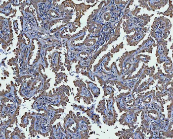 TRIM16 Rabbit Polyclonal Antibody