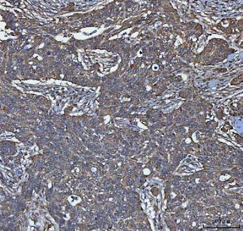 TRIM16 Rabbit Polyclonal Antibody