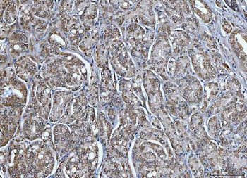 TRIM16 Rabbit Polyclonal Antibody
