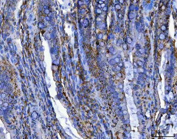TRIM16 Rabbit Polyclonal Antibody