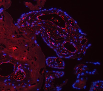 TP53I13 Rabbit Polyclonal Antibody