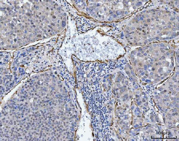 TP53I13 Rabbit Polyclonal Antibody