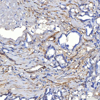 TP53I13 Rabbit Polyclonal Antibody
