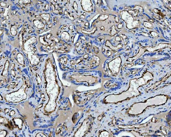 TP53I13 Rabbit Polyclonal Antibody