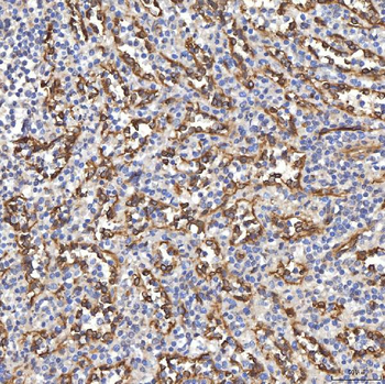 TP53I13 Rabbit Polyclonal Antibody