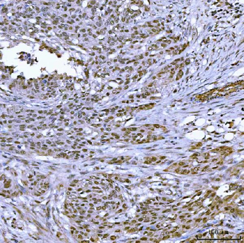 TOP3B Rabbit Polyclonal Antibody
