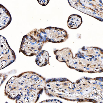 TOP3B Rabbit Polyclonal Antibody