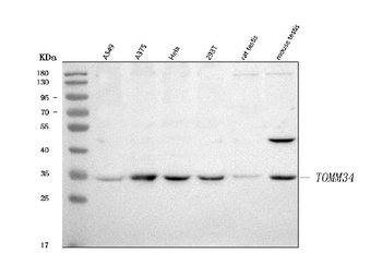 TOMM34 Rabbit Polyclonal Antibody