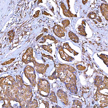 TOMM34 Rabbit Polyclonal Antibody