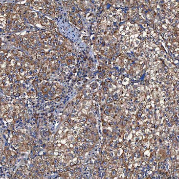 TOMM34 Rabbit Polyclonal Antibody