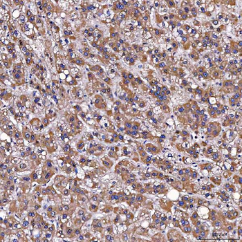 TOMM34 Rabbit Polyclonal Antibody