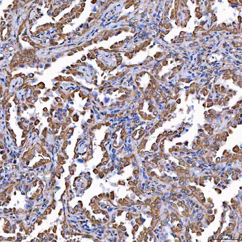 TOMM34 Rabbit Polyclonal Antibody