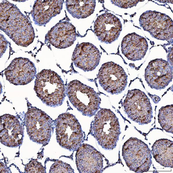 TOMM34 Rabbit Polyclonal Antibody