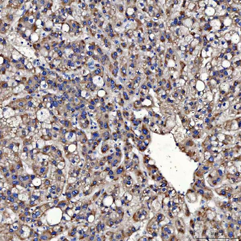 TOM1L1 Antibody