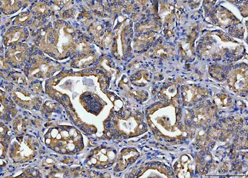 TOLLIP Rabbit Polyclonal Antibody