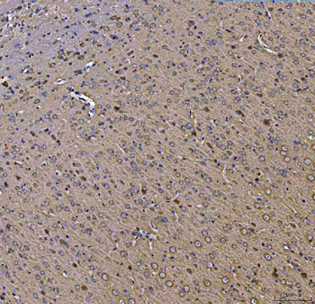 TOLLIP Rabbit Polyclonal Antibody