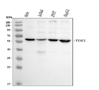 TOE1 Rabbit Polyclonal Antibody
