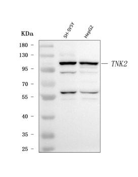 ACK1/TNK2 Rabbit Polyclonal Antibody
